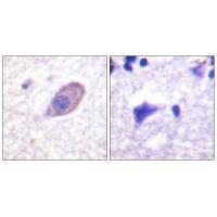 Kir5.1 (Ab-416) Antibody