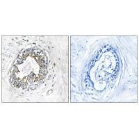 PAK1/2 (Ab-199) Antibody