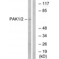 PAK1/2 (Ab-199) Antibody