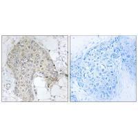 PPP1R2 (Ab-120/121) Antibody