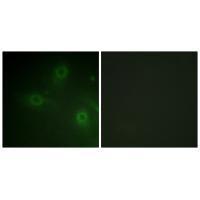 Neutrophil Cytosol Factor 1 (Ab-304) Antibody