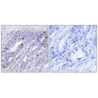 Nuclear Receptor NR4A1 (Ab-351) Antibody