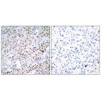 CREB (Ab-129/133) Antibody