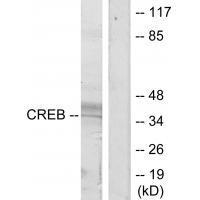 CREB (Ab-129/133) Antibody