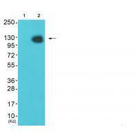 HDAC4 (Ab-632) Antibody