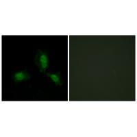 IRS-1 (Ab-312) Antibody