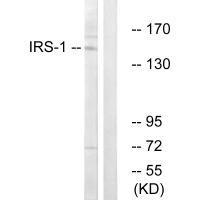 IRS-1 (Ab-312) Antibody