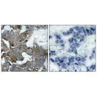 IκB-α (Ab-32/36) Antibody