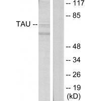 Tau (Ab-396) Antibody