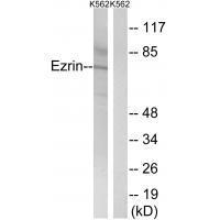 Ezrin (Ab-478) Antibody