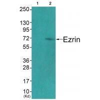 Ezrin (Ab-478) Antibody