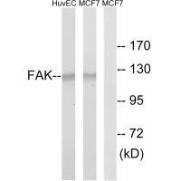 FAK (Ab-843) Antibody