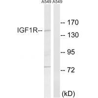 IGF1R (Ab-1346) Antibody