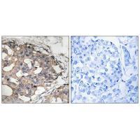 B-RAF (Ab-446) Antibody