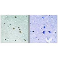 ILK (Ab-246) Antibody