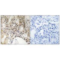 LATS1/2 Antibody