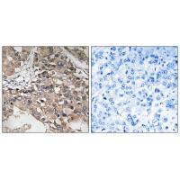 MAP3K7 (Ab-187) Antibody
