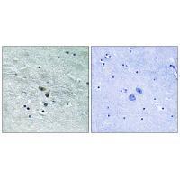 MAP3K8 (Ab-400) Antibody