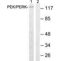 PEK/PERK (Ab-981) Antibody