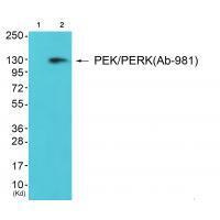 PEK/PERK (Ab-981) Antibody