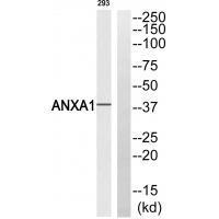 ANXA1 (Ab-21) Antibody