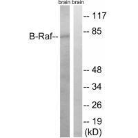B-Raf (Ab-753) Antibody