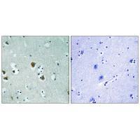 CRMP-2 (Ab-509) Antibody