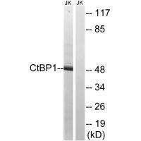 CtBP1 (Ab-422) Antibody