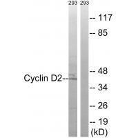 Cyclin D2 (Ab-280) Antibody
