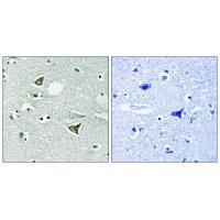 Girdin Antibody