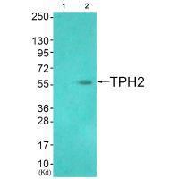 TPH2 (Ab-19) Antibody