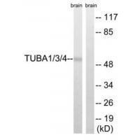 TUBA1/3/4 (Ab-272) Antibody