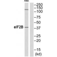 eIF2B (Ab-67) Antibody
