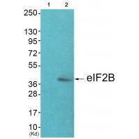 eIF2B (Ab-67) Antibody