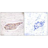 Annexin A6 Antibody