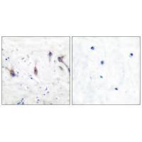 ARC Antibody