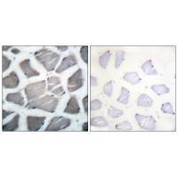 Bak Antibody