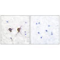 Bax Antibody