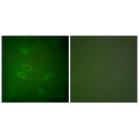 CARD6 Antibody
