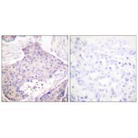 CARD6 Antibody