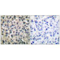 Catenin-γ Antibody