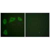 Caveolin-1 Antibody 