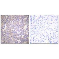 Claudin 2 Antibody