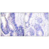 Claudin 3 Antibody