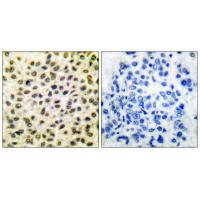 Fos Antibody