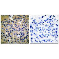 Collagen II Antibody