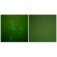 Collagen III Antibody