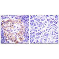 Collagen III Antibody