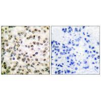 CREB-BP Antibody