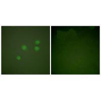 Cyclin E1 Antibody 